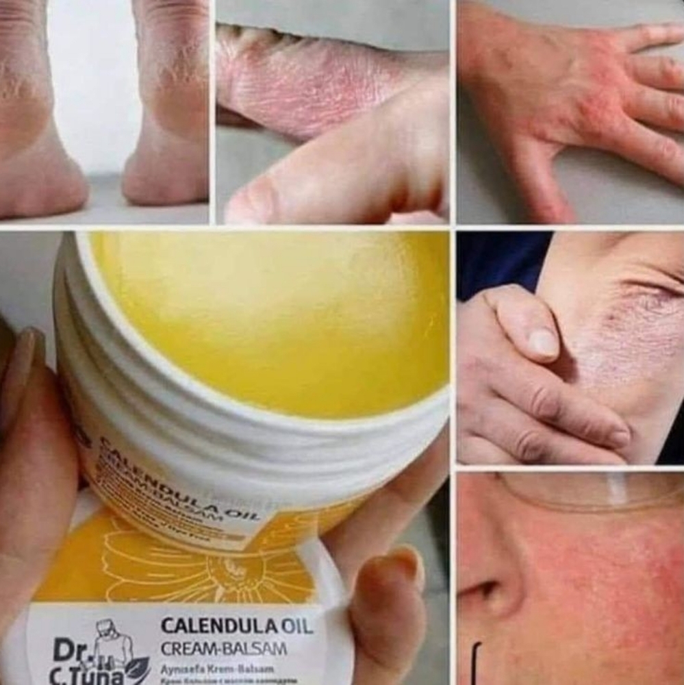 Calendula Balm